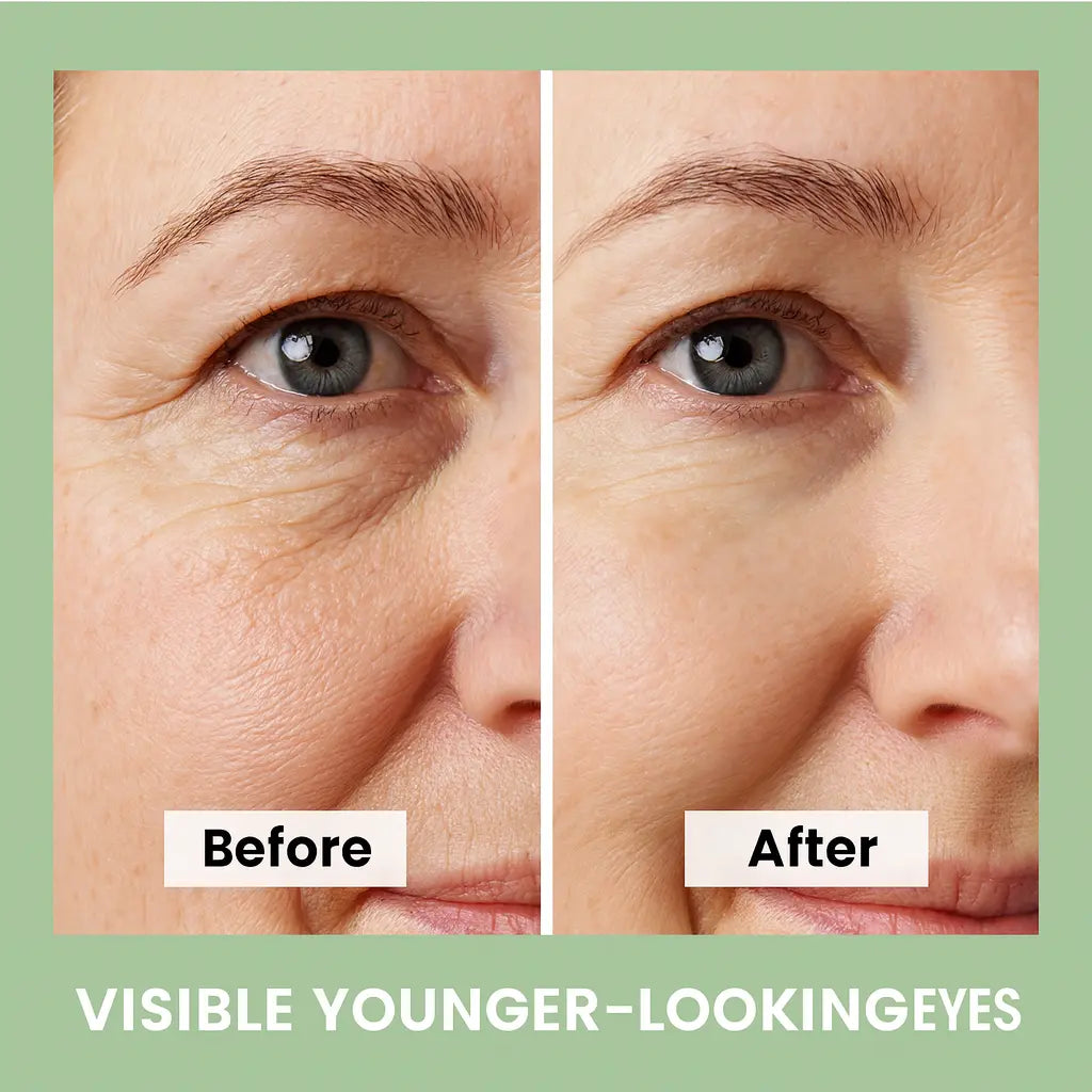 Anti-Aging Eye Cream | Wrinkle Reduction Cream | Novara Shop