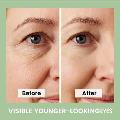 Anti-Aging Eye Cream | Wrinkle Reduction Cream | Novara Shop